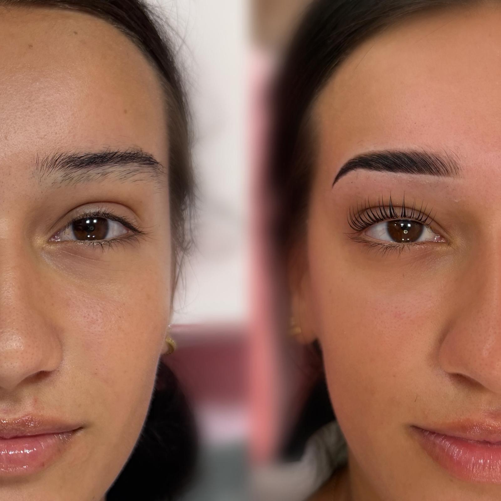 brows